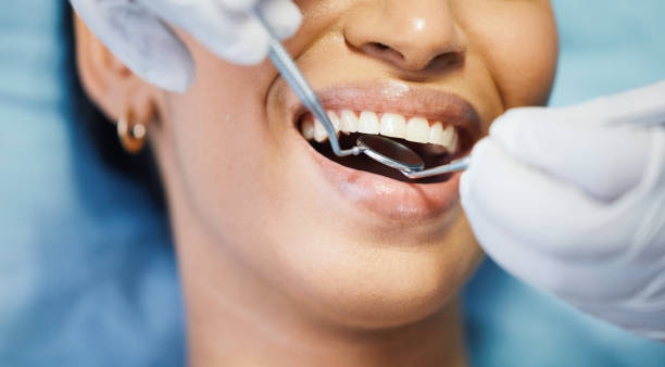 Best Emergency Wisdom Teeth Removal in Goodyear, AZ